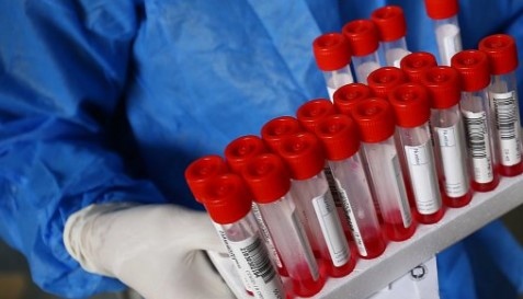 265 са новите случаи на коронавирус при направени 4134 теста